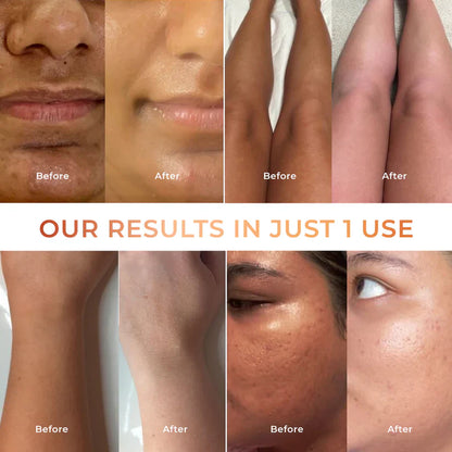 Buy 1 Get 1 Free Niconi Tan Vanish Gluta-Kojic Skin Polish 180g